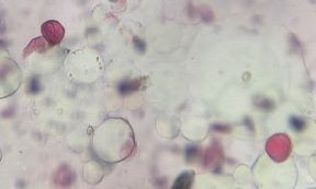Oak pollen under a microscope, verified by PollyMap