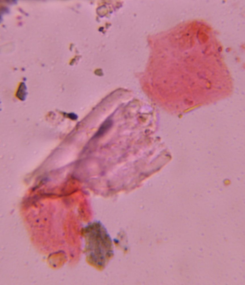 Microscope image of Epithelial fragments, verified by PollyMap