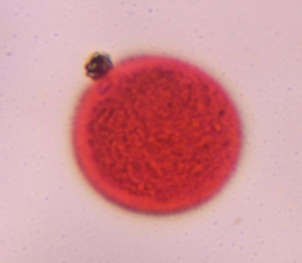Grass pollen pollen under a microscope, verified by PollyMap