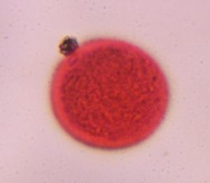 Grass pollen pollen under a microscope, verified by PollyMap