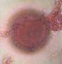 unidentified pollen under a microscope, verified by PollyMap