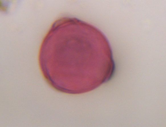 Artemisia pollen under a microscope, verified by PollyMap