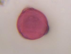 Artemisia pollen under a microscope, verified by PollyMap