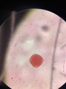 Elm (Ulmus) pollen under a microscope, verified by PollyMap