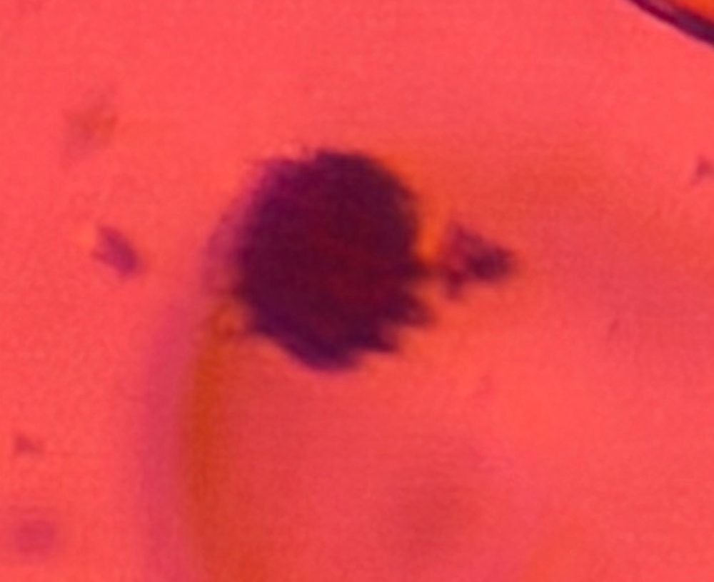 Another microscope image of Asteraceae, verified by PollyMap