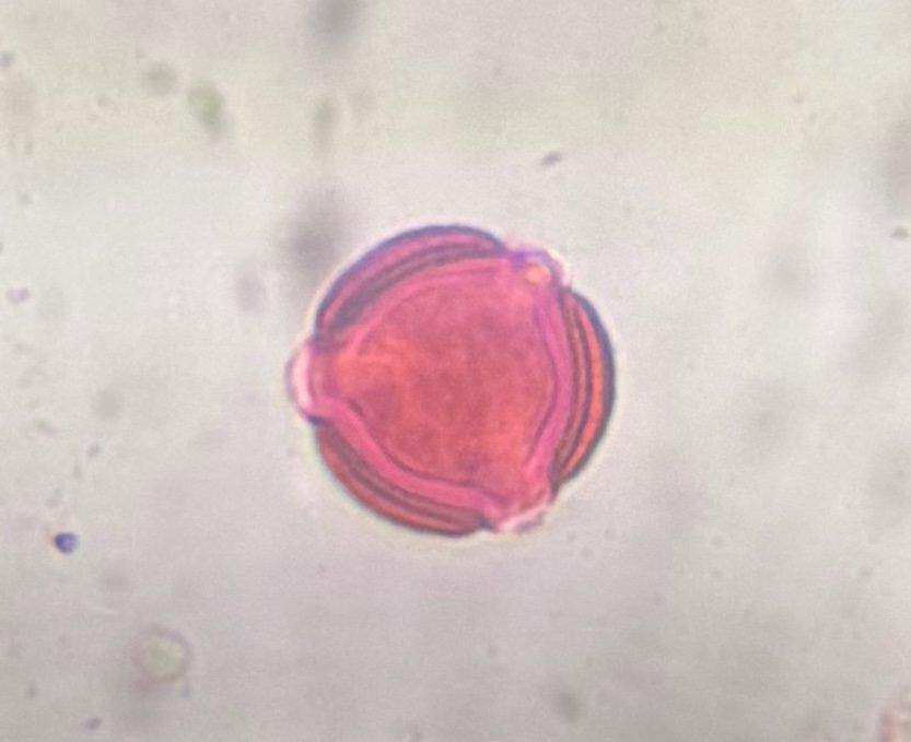 Another microscope image of Artemisia, verified by PollyMap