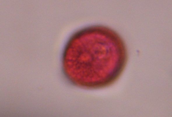 Artemisia pollen under a microscope, verified by PollyMap