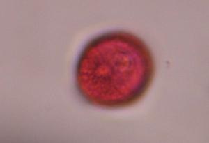 Artemisia pollen under a microscope, verified by PollyMap