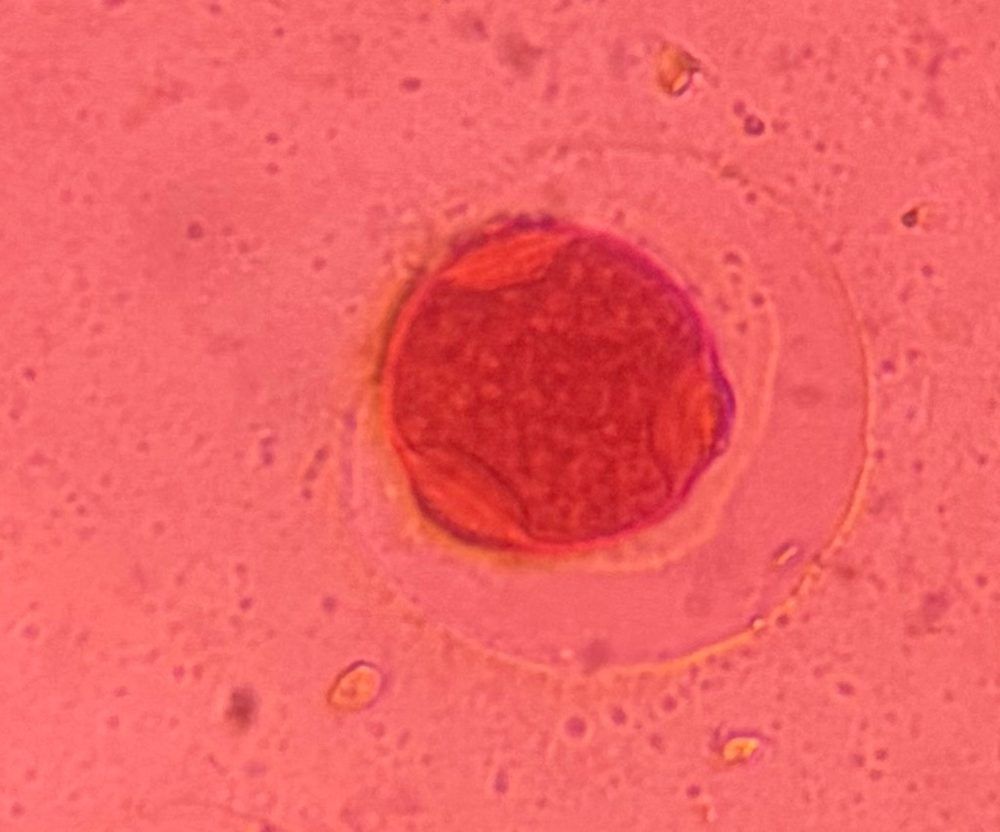 Hackberry pollen under a microscope, verified by PollyMap