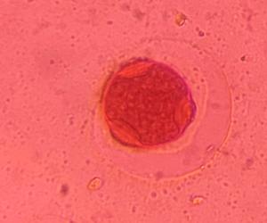 Hackberry pollen under a microscope, verified by PollyMap