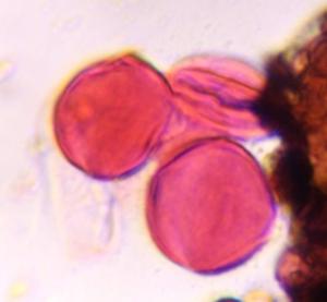 unknown pollen under a microscope, verified by PollyMap