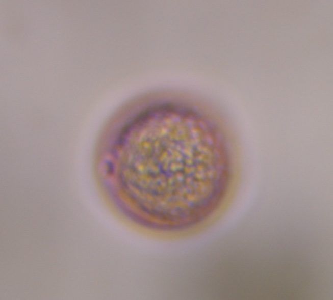 Poaceae pollen under a microscope, verified by PollyMap