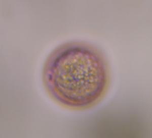 Poaceae pollen under a microscope, verified by PollyMap