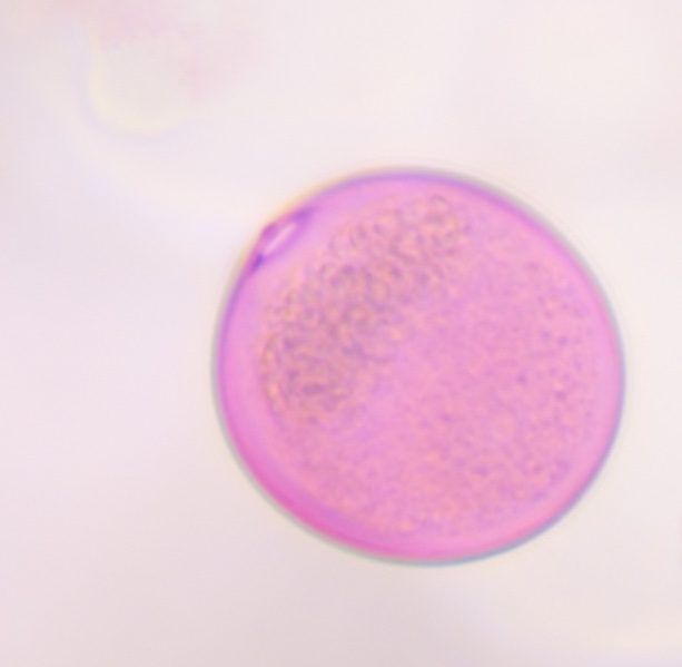 Grass pollen under a microscope, verified by PollyMap