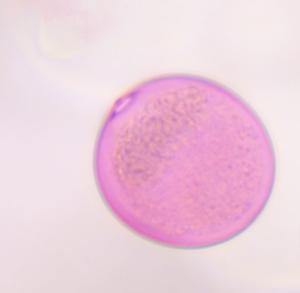 Grass pollen under a microscope, verified by PollyMap