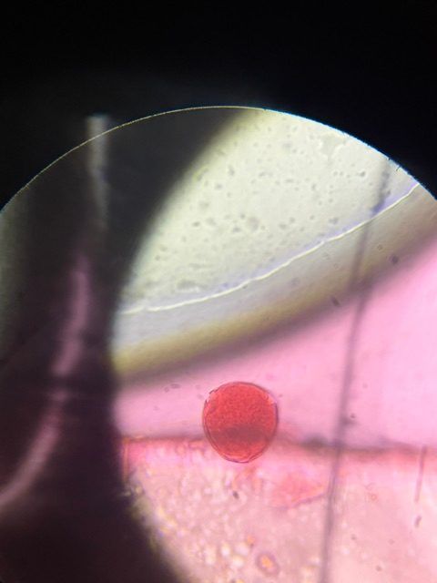 Grass pollen under a microscope, verified by PollyMap