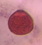 Mulberry pollen under a microscope, verified by PollyMap