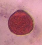 Mulberry pollen under a microscope, verified by PollyMap