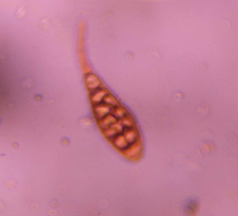 Alternaria mold spore under a microscope, verified by PollyMap