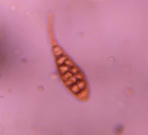 Alternaria mold spore under a microscope, verified by PollyMap