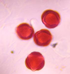 Artemisia pollen under a microscope, verified by PollyMap
