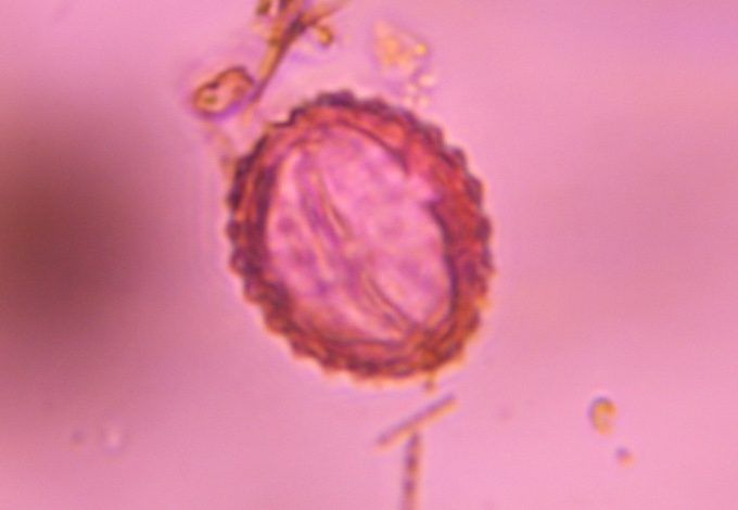 Asteraceae pollen under a microscope, verified by PollyMap