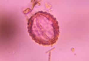Asteraceae pollen under a microscope, verified by PollyMap