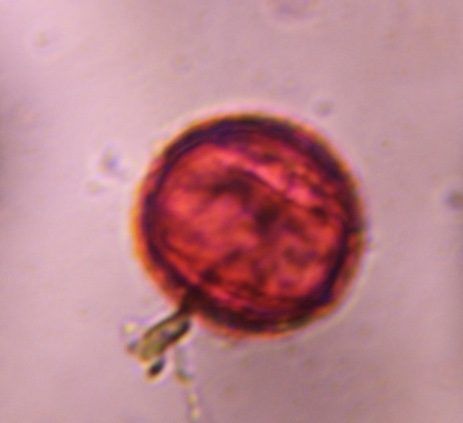 Microscope image of unknown, verified by PollyMap