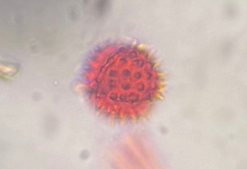 Another microscope image of Asteraceae, verified by PollyMap