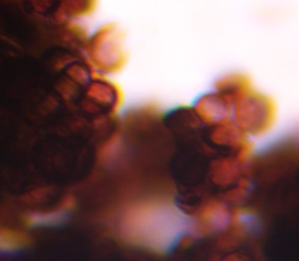 Epicoccum mold spore under a microscope, verified by PollyMap