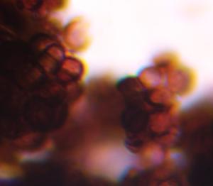 Epicoccum mold spore under a microscope, verified by PollyMap