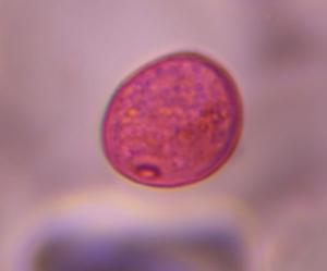 Poaceae pollen under a microscope, verified by PollyMap