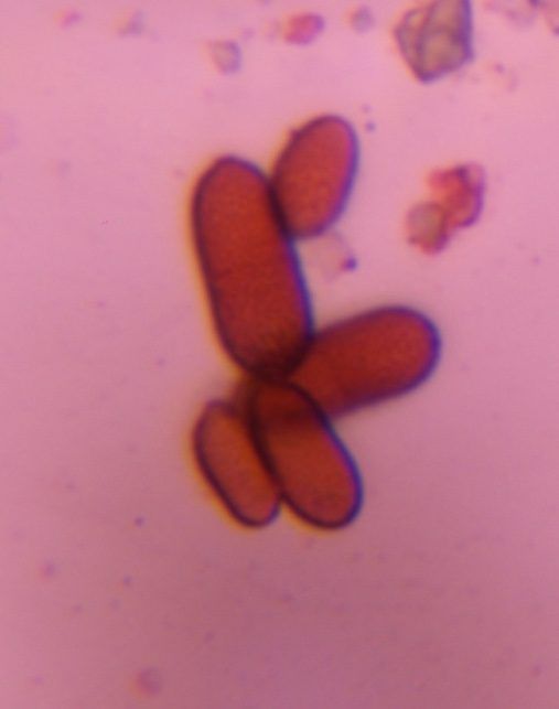 Microscope image of Ascospore, verified by PollyMap