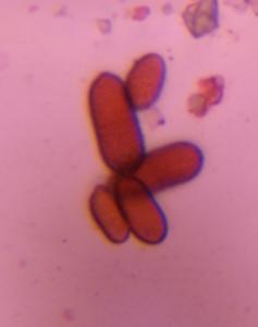 Ascospore mold spore under a microscope, verified by PollyMap