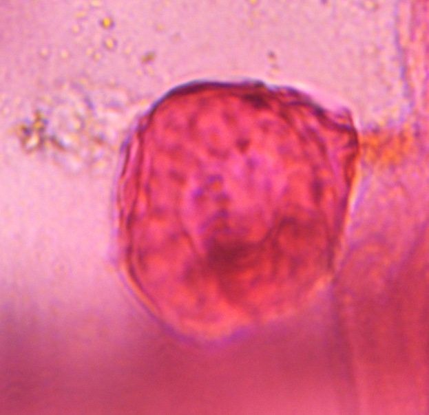 unknown pollen under a microscope, verified by PollyMap