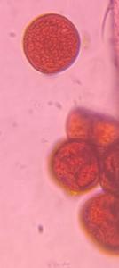 Grass pollen under a microscope, verified by PollyMap