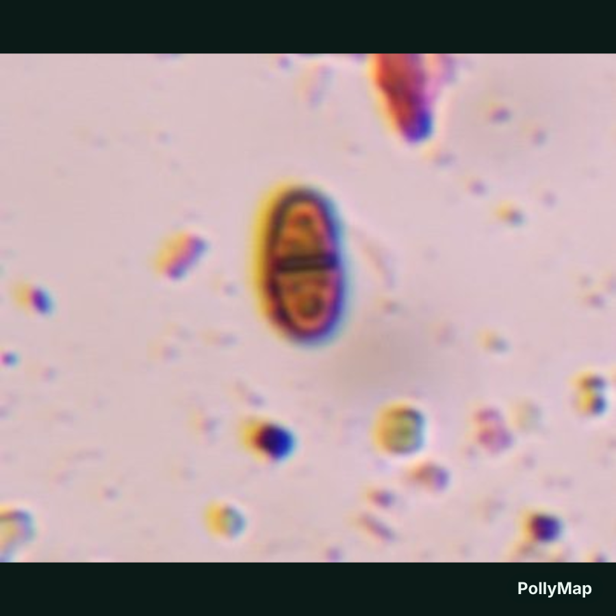 Microscope image of Dematiaceous ascospore, verified by PollyMap