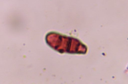 Curvularia mold spore under a microscope, verified by PollyMap