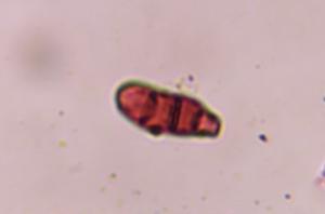 Curvularia mold spore under a microscope, verified by PollyMap