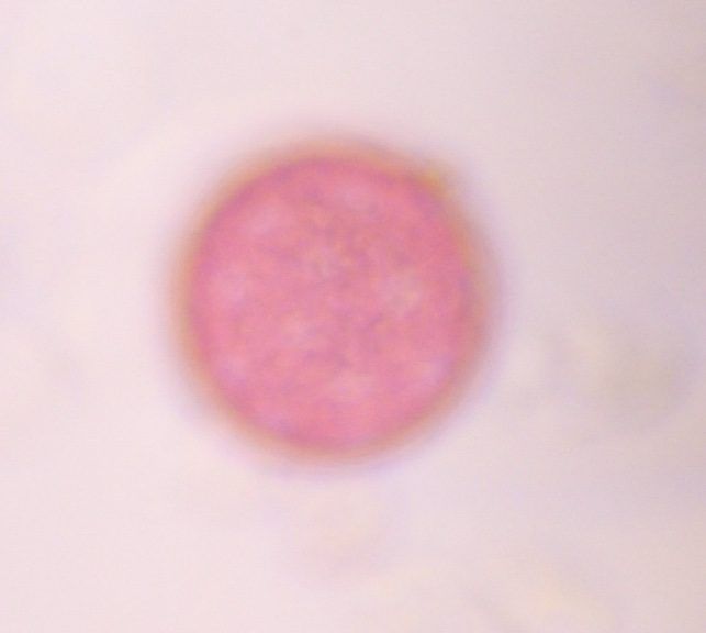 Chenopod pollen under a microscope, verified by PollyMap