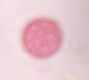 Chenopod pollen under a microscope, verified by PollyMap