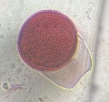 Grass pollen under a microscope, verified by PollyMap