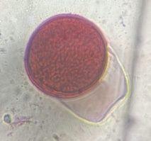 Grass pollen under a microscope, verified by PollyMap