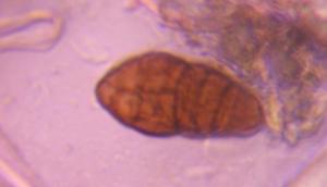 Ulocladium mold spore under a microscope, verified by PollyMap