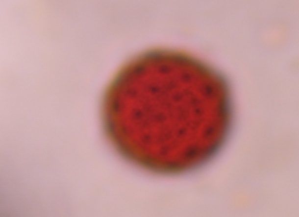 Another microscope image of Chenopod, verified by PollyMap