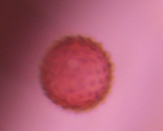 Asteraceae pollen under a microscope, verified by PollyMap