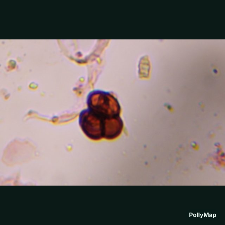Microscope image of Epicoccum, verified by PollyMap