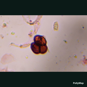 Epicoccum mold spore under a microscope, verified by PollyMap