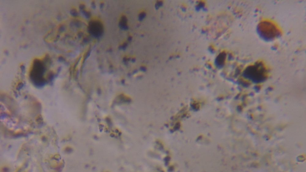 Dust house dust under a microscope, verified by PollyMap