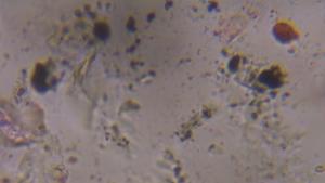 Dust house dust under a microscope, verified by PollyMap